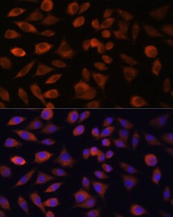 Invitrogen TRIM47 Polyclonal Antibody 100 &mu;L; Unconjugated:Antibodies,