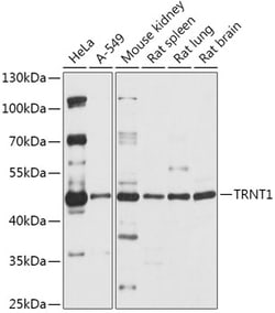 Invitrogen TRNT1 Polyclonal Antibody 100 &mu;L; Unconjugated:Antibodies,