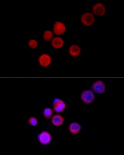 Invitrogen TRPC5 Polyclonal Antibody 100 &mu;L; Unconjugated:Antibodies,