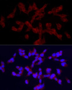 Invitrogen TRPC5 Polyclonal Antibody 100 &mu;L; Unconjugated:Antibodies,