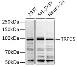 Invitrogen TRPC5 Polyclonal Antibody 100 &mu;L; Unconjugated:Antibodies,
