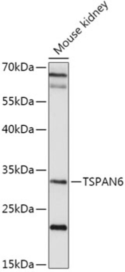 Invitrogen TSPAN6 Polyclonal Antibody 100 μL; Unconjugated:Antibodies,