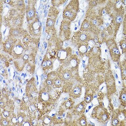 Invitrogen TST Polyclonal Antibody 100 &mu;L | Buy Online | Invitrogen&trade; | Fisher Scientific