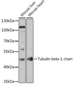 Invitrogen TUBB1 Polyclonal Antibody 100 &mu;L; Unconjugated:Antibodies,