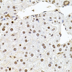Invitrogen SR140 Polyclonal Antibody 100 &mu;L; Unconjugated:Antibodies,