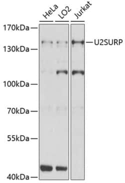 Invitrogen SR140 Polyclonal Antibody 100 &mu;L; Unconjugated:Antibodies,
