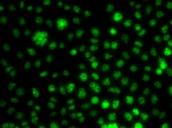 Invitrogen UBE2R2 Polyclonal Antibody 100 &mu;L; Unconjugated:Antibodies,