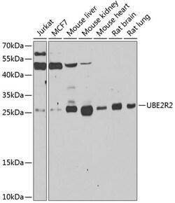 Invitrogen UBE2R2 Polyclonal Antibody 100 &mu;L; Unconjugated:Antibodies,