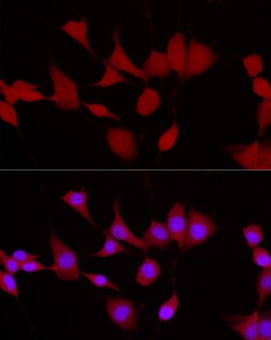 Invitrogen UCHL5 Polyclonal Antibody 100 &mu;L; Unconjugated:Antibodies,