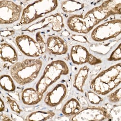 Invitrogen UCHL5 Polyclonal Antibody 100 &mu;L; Unconjugated:Antibodies,
