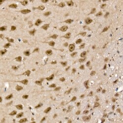 Invitrogen UCHL5 Polyclonal Antibody 100 &mu;L; Unconjugated:Antibodies,