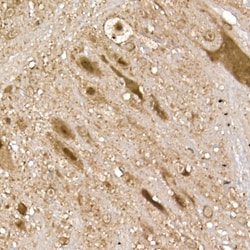 Invitrogen UCHL5 Polyclonal Antibody 100 &mu;L; Unconjugated:Antibodies,