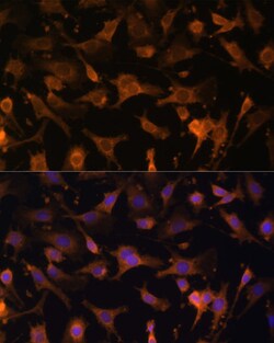 Invitrogen UFC1 Polyclonal Antibody 100 μL; Unconjugated:Antibodies,