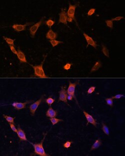 Invitrogen UFC1 Polyclonal Antibody 100 μL; Unconjugated:Antibodies,