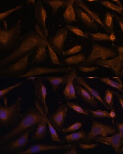 Invitrogen UFC1 Polyclonal Antibody 100 μL; Unconjugated:Antibodies,