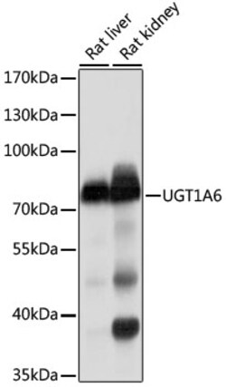 Invitrogen UGT1A6 Polyclonal Antibody 100 &mu;L; Unconjugated:Antibodies,