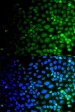 Invitrogen ULK4 Polyclonal Antibody 100 &mu;L; Unconjugated:Antibodies,