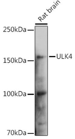Invitrogen ULK4 Polyclonal Antibody 100 &mu;L; Unconjugated:Antibodies,