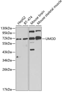 Invitrogen Uromodulin Polyclonal Antibody 100 &mu;L; Unconjugated:Antibodies,
