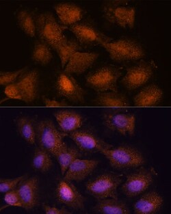 Invitrogen UPF3A Polyclonal Antibody 100 &mu;L; Unconjugated:Antibodies,