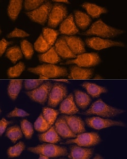 Invitrogen UPF3A Polyclonal Antibody 100 &mu;L; Unconjugated:Antibodies,