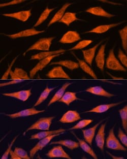 Invitrogen UPF3A Polyclonal Antibody 100 &mu;L; Unconjugated:Antibodies,