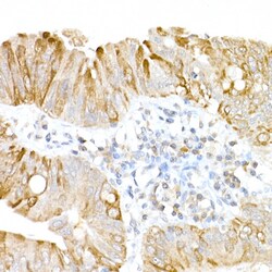 Invitrogen USP18 Polyclonal Antibody 100 &mu;L; Unconjugated:Antibodies,