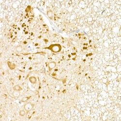 Invitrogen USP18 Polyclonal Antibody 100 &mu;L; Unconjugated:Antibodies,