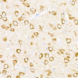 Invitrogen USP18 Polyclonal Antibody 100 &mu;L; Unconjugated:Antibodies,
