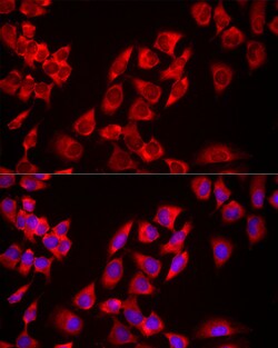 Invitrogen USP21 Polyclonal Antibody 100 &mu;L; Unconjugated:Antibodies,