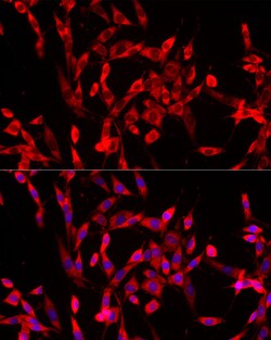 Invitrogen USP21 Polyclonal Antibody 100 &mu;L; Unconjugated:Antibodies,