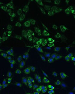 Invitrogen USP46 Polyclonal Antibody 100 &mu;L; Unconjugated:Antibodies,
