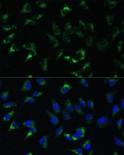 Invitrogen USP46 Polyclonal Antibody 100 &mu;L; Unconjugated:Antibodies,