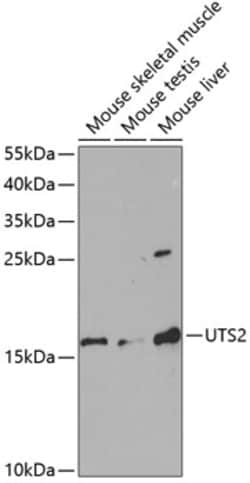 Invitrogen UTS2 Polyclonal Antibody 100 &mu;L; Unconjugated:Antibodies,