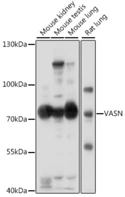 VASN Polyclonal Antibody:Antibodies, Polyclonal