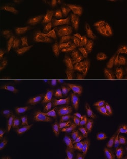 Invitrogen Alix Polyclonal Antibody 100 &mu;L; Unconjugated:Antibodies,