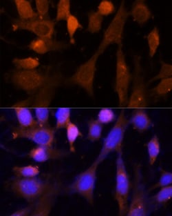 Invitrogen VPS26A Polyclonal Antibody 100 &mu;L; Unconjugated:Antibodies,