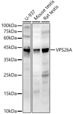 Invitrogen VPS26A Polyclonal Antibody 100 &mu;L; Unconjugated:Antibodies,