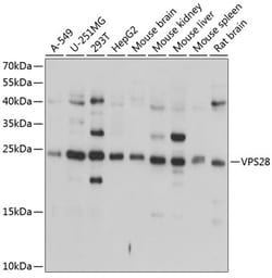 Invitrogen VPS28 Polyclonal Antibody 100 &mu;L; Unconjugated:Antibodies,