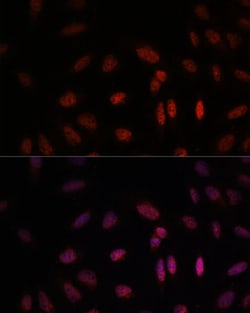 Invitrogen WDR18 Polyclonal Antibody 100 μL; Unconjugated:Antibodies,
