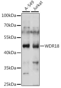 Invitrogen WDR18 Polyclonal Antibody 100 μL; Unconjugated:Antibodies,