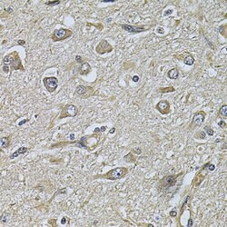 WIPI1 Polyclonal Antibody, Invitrogen 100 &mu;L; Unconjugated:Antibodies,