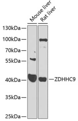 Invitrogen ZDHHC9 Polyclonal Antibody 100 &mu;L; Unconjugated:Antibodies,