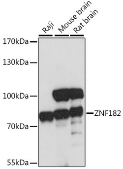 Invitrogen ZNF182 Polyclonal Antibody 100 &mu;L; Unconjugated:Antibodies,