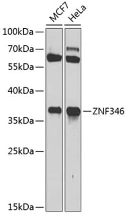 Invitrogen ZNF346 Polyclonal Antibody 100 &mu;L; Unconjugated:Antibodies,