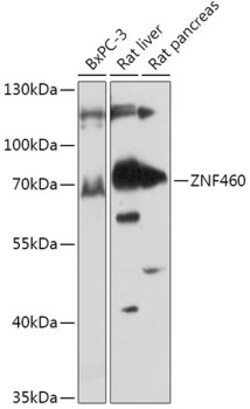 Invitrogen ZNF460 Polyclonal Antibody 100 &mu;L; Unconjugated:Antibodies,