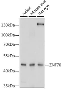 Invitrogen ZNF70 Polyclonal Antibody 100 μL; Unconjugated:Antibodies,