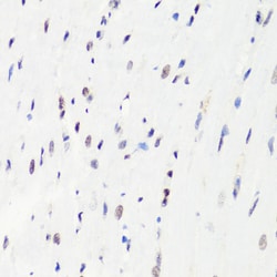 Invitrogen H3R8me1 Polyclonal Antibody 100 μL; Unconjugated:Antibodies,