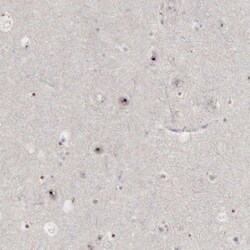 Invitrogen DKC1 Polyclonal Antibody:Antibodies:Primary Antibodies