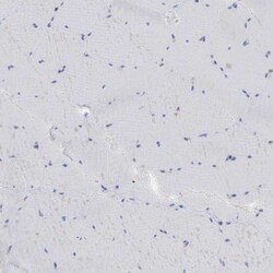 Invitrogen DKC1 Polyclonal Antibody:Antibodies:Primary Antibodies